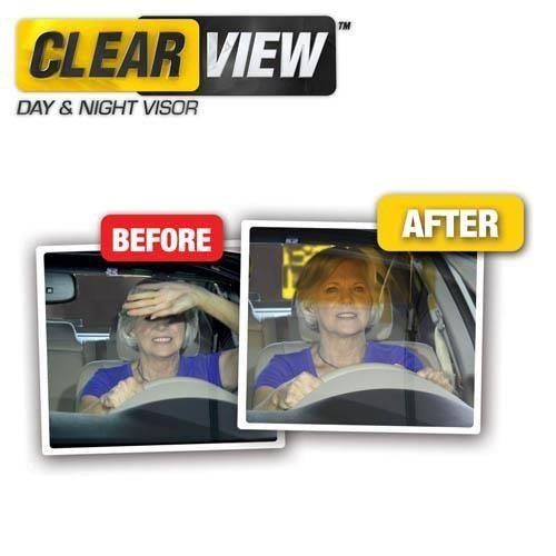 CLEAR VIEW X2 - belteleachat